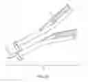Fig. 37 - Implant and method for long bone fixation