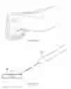 Fig. 44 - Implant and method for long bone fixation