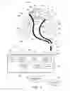 Fig. 02 - Orthodontic system with tooth movement and position measuring, monitoring, and control