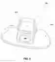 Fig. 05 - ORTHODONTIC DISCOMFORT REDUCTION USING HIGH FREQUENCY STIMULATION