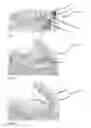 Fig. 02 - METHOD FOR PRODUCING A PARTIAL OR TOTAL PROSTHESIS, AND PROSTHESIS OBTAINABLE BY THIS METHOD