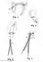 Fig. 02 - Implants, tools, and methods for treatments of pelvic conditions