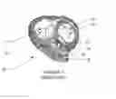 Fig. 02 - Assistive device for a cardiac valve