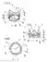 Fig. 04 - Prosthetic heart valve