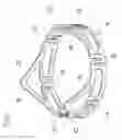 Fig. 06 - Prosthetic heart valve