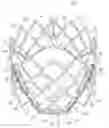 Fig. 01 - Prosthetic heart valve with reduced stitching