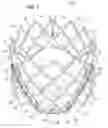 Fig. 02 - Prosthetic heart valve with reduced stitching