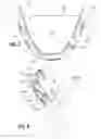 Fig. 05 - Prosthetic heart valve with reduced stitching