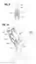 Fig. 06 - Prosthetic heart valve with reduced stitching