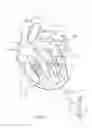 Fig. 02 - APICAL CONTROL OF TRANSVASCULAR DELIVERY OF PROSTHETIC MITRAL VALVE