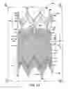 Fig. 02 - Venous valve, system and method