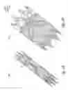 Fig. 08 - Venous valve, system and method