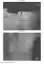 Fig. 17 - Cartilage mosaic compositions and methods