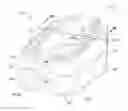 Fig. 01 - Expandable intervertebral fusion implant