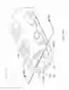 Fig. 22 - Expandable intervertebral fusion implant