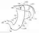 Fig. 01 - Safe sleeve gastrectomy