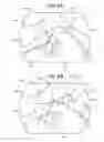 Fig. 06 - Safe sleeve gastrectomy