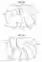 Fig. 08 - Safe sleeve gastrectomy