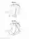 Fig. 04 - Safe sleeve gastrectomy and intestinal switch