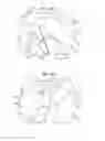 Fig. 07 - Safe sleeve gastrectomy and intestinal switch