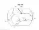 Fig. 09 - Safe sleeve gastrectomy and intestinal switch