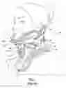 Fig. 02 - Cervical collar