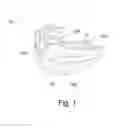 Fig. 02 - DEVICE FOR FITTING TO A USER'S MANDIBLE