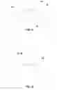Fig. 07 - System for correcting an irregular surface of a cornea and uses thereof