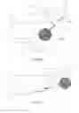 Fig. 08 - Surgical assemblies for ocular surgery, systems and methods of compensation of intraocular pressure
