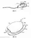 Fig. 07 - Intraocular drainage device