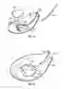 Fig. 09 - Intraocular drainage device
