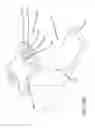 Fig. 35 - Table adapters for mounting robotic arms to a surgical table