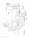 Fig. 83 - Table adapters for mounting robotic arms to a surgical table