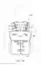 Fig. 14 - METHOD OF CLEARING A BIOLOGICAL AIRWAY USING A SELF-CONTAINED PORTABLE POSITIONABLE OSCILLATING MOTOR ARRAY