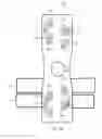 Fig. 20 - METHOD OF CLEARING A BIOLOGICAL AIRWAY USING A SELF-CONTAINED PORTABLE POSITIONABLE OSCILLATING MOTOR ARRAY