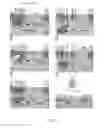 Fig. 03 - Methods for treating hemolytic diseases and sickle cell disease