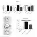 Fig. 02 - METHODS OF TREATING AND PREVENTING ALLOANTIBODY DRIVEN CHRONIC GRAFT VERSUS HOST DISEASE