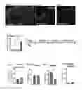 Fig. 02 - METHODS AND COMPOSITIONS FOR TREATING ALZHEIMER'S DISEASE AND OTHER MEMORY-ASSOCIATED DISORDERS AND CONDITIONS