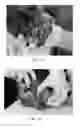 Fig. 02 - MACROPHAGE ACTIVATING FACTOR FOR TREATING BENIGN OR PRECANCEROUS PAPILLOMAS