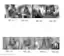 Fig. 06 - MACROPHAGE ACTIVATING FACTOR FOR TREATING BENIGN OR PRECANCEROUS PAPILLOMAS