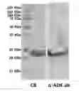 Fig. 02 - Antibacterial composition for combating carbapenem-resistant gram-negative bacteria comprising ADK protein as active ingredient