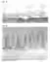 Fig. 03 - Microneedle and method for producing same