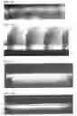 Fig. 05 - Microneedle and method for producing same