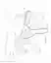 Fig. 02 - Humidifier reservoir