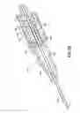 Fig. 46 - Needle capture safety interlock for catheter