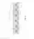 Fig. 06 - Catheter and balloon catheter
