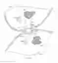 Fig. 06 - Anastomotic drainage stent