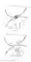 Fig. 07 - Anastomotic drainage stent