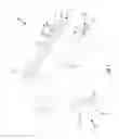 Fig. 02 - CANNULA WITH CURVED END