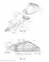 Fig. 19 - Low-profile single and dual vascular access device